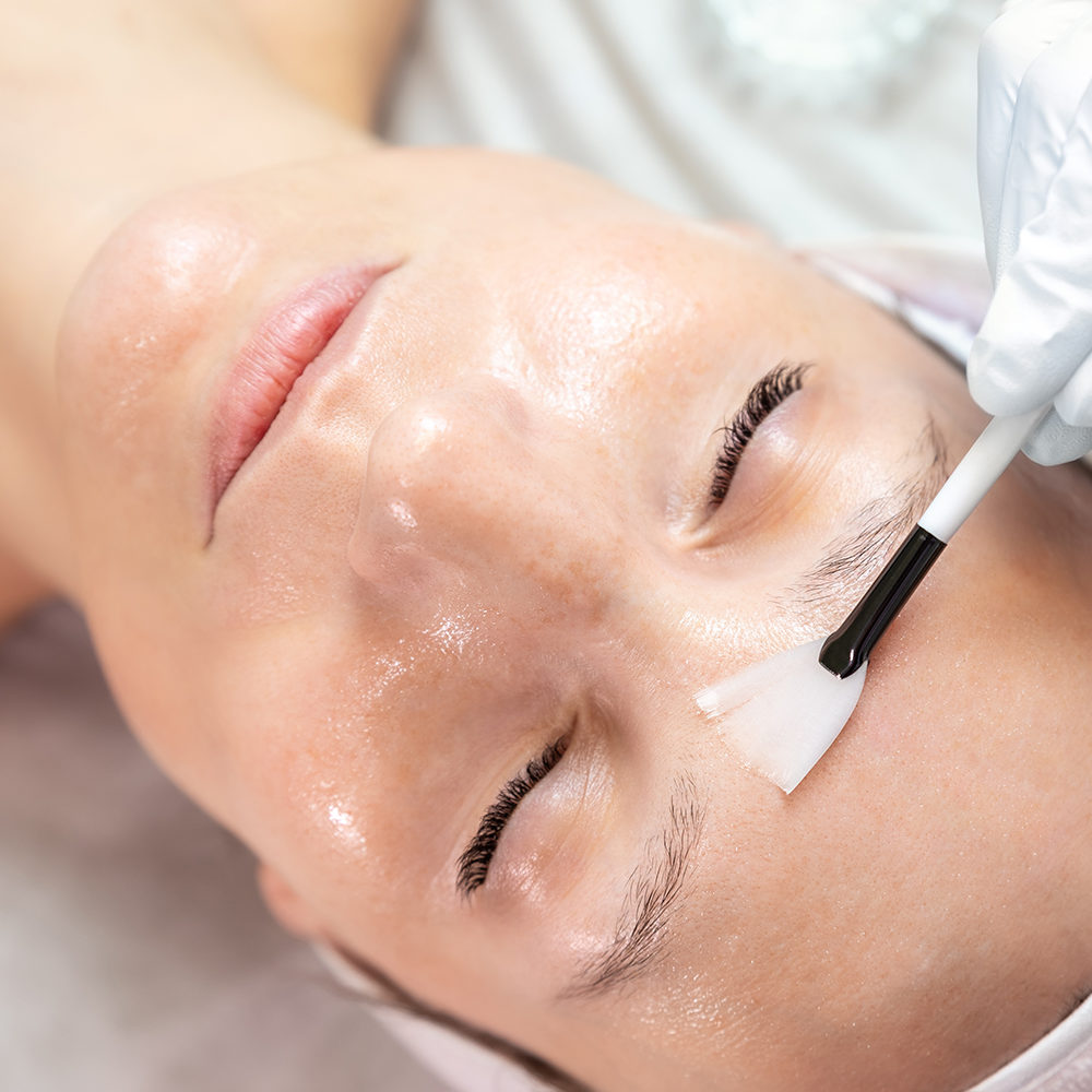 online-chemical-peel-course