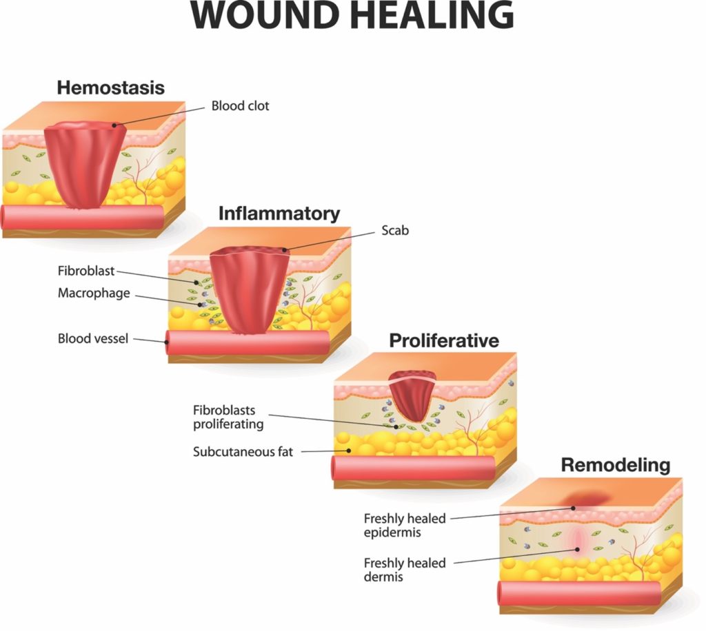 Wound Healing Process - The Beauty Training School