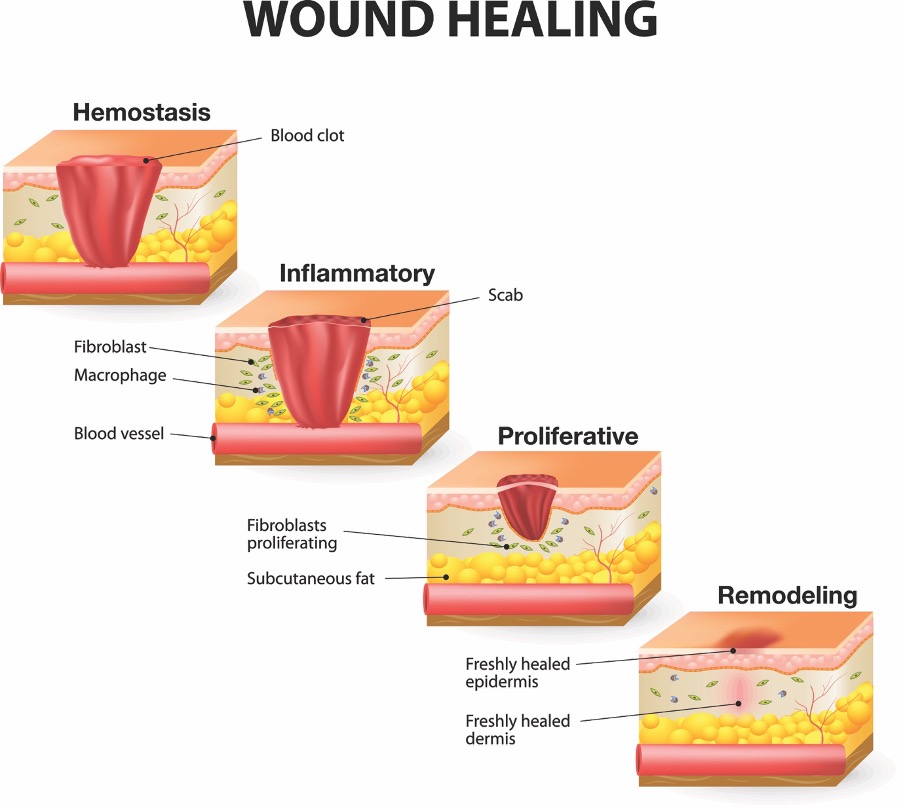 The Wound Healing Process - The Beauty Training School